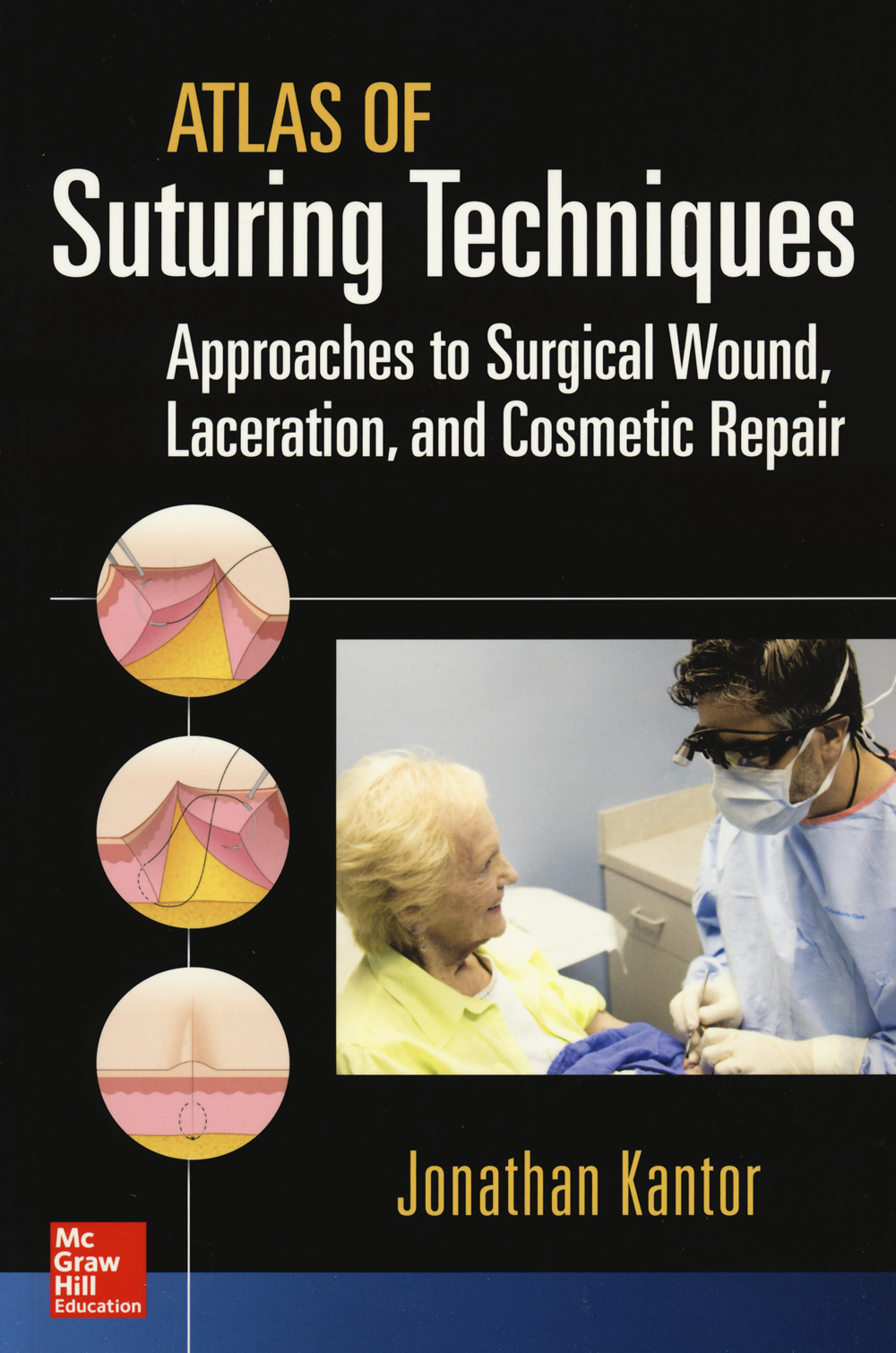 Atlas of suturing techniques. Approaches to surgical wound, laceration and cosmetic repair