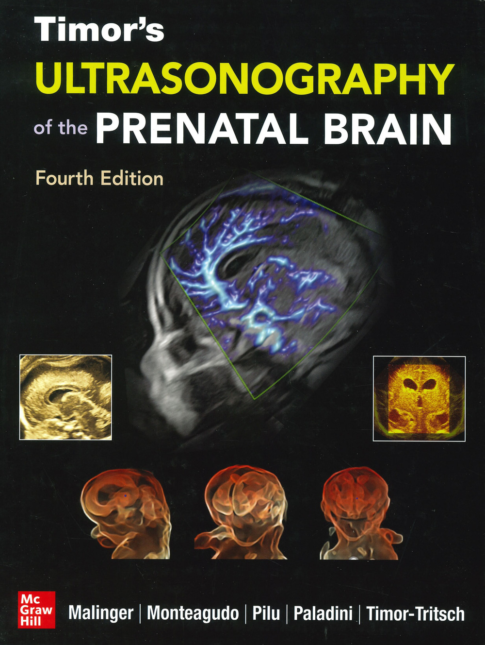 Ultrasonography of the prenatal brain