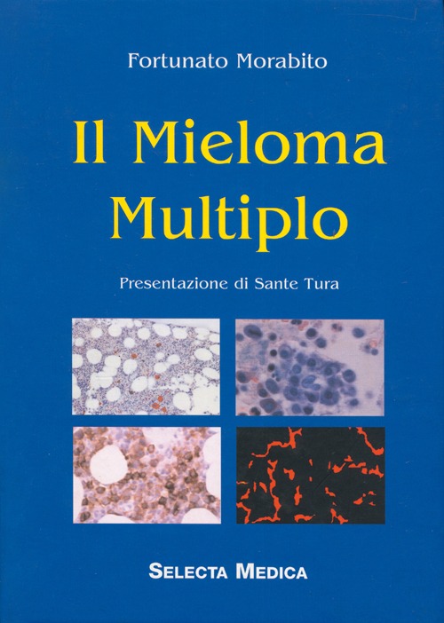 Il mieloma multiplo