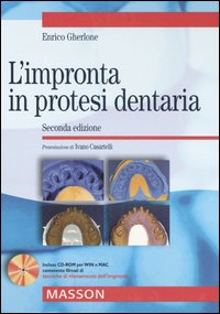 L'impronta in protesi dentaria