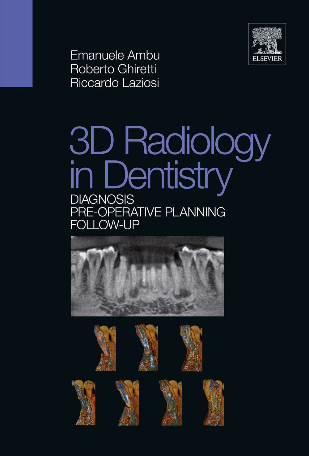 3D radiology in dentistry. Diagnosis pre-operative planning follow-up
