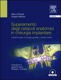 Superamento degli ostacoli anatomici in chirurgia implantare. Implantologia computer-guidata innesti ossei