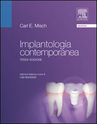 Implantologia contemporanea