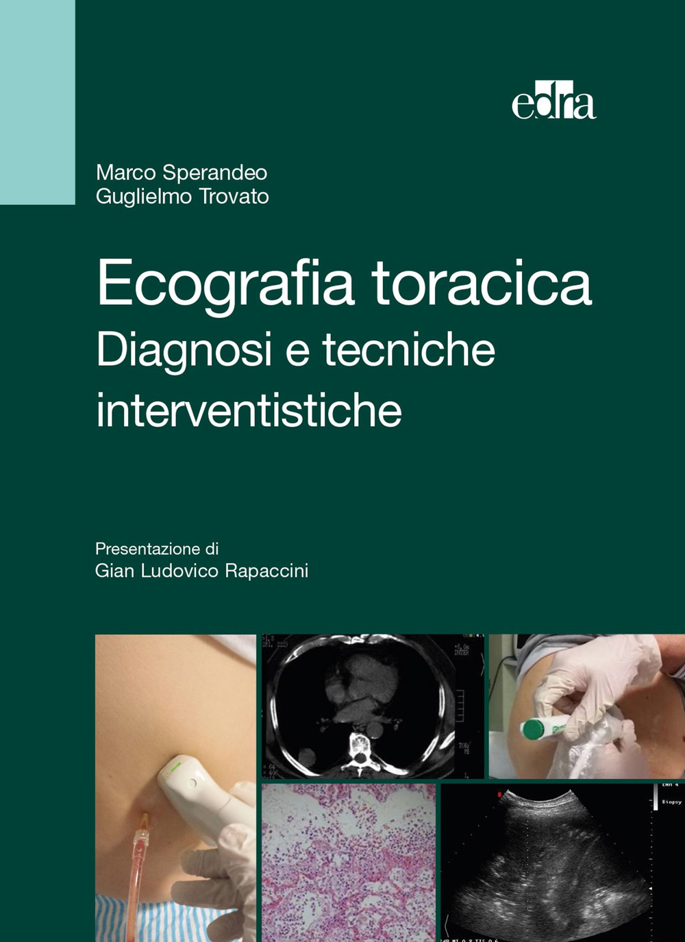 Ecografia toracica. Diagnosi e tecniche interventistiche