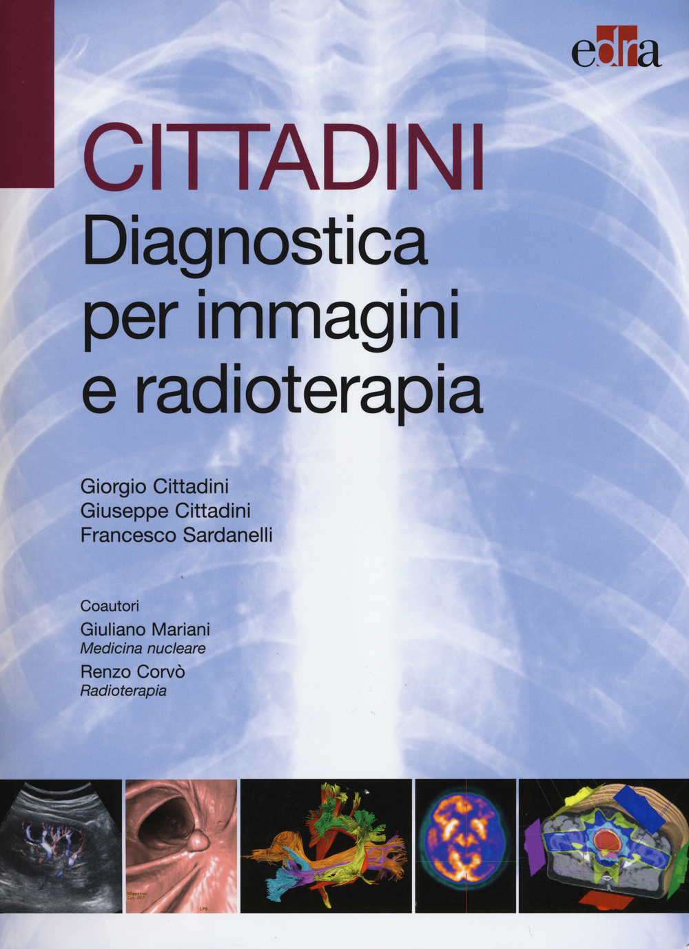 Cittadini. Diagnostica per immagini e radioterapia
