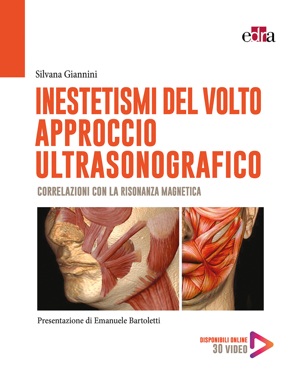 Inestetismi del volto. Approccio ultrasonografico. Correlazioni con la risonanza magnetica