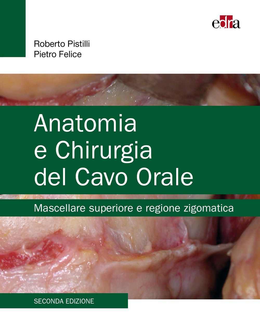 Anatomia e chirurgia del cavo orale. Mascellare superiore e regione zigomatica