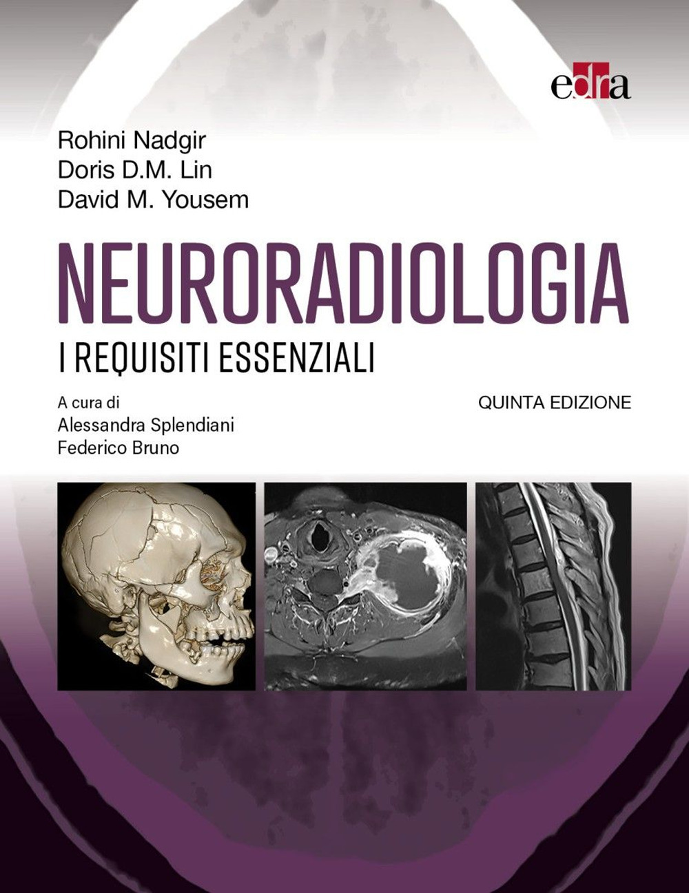 Neuroradiologia. I requisiti essenziali