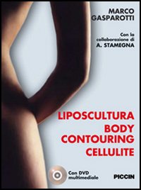Liposcultura body contouring cellulite