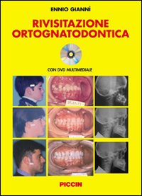 Rivisitazione ortognatodontica