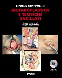 Blefaroplastica e tecniche ancillari