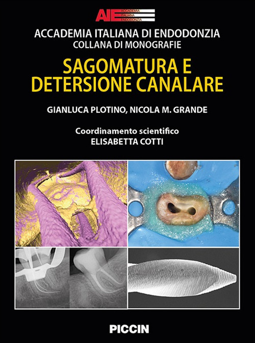 Sagomatura e detersione canalare