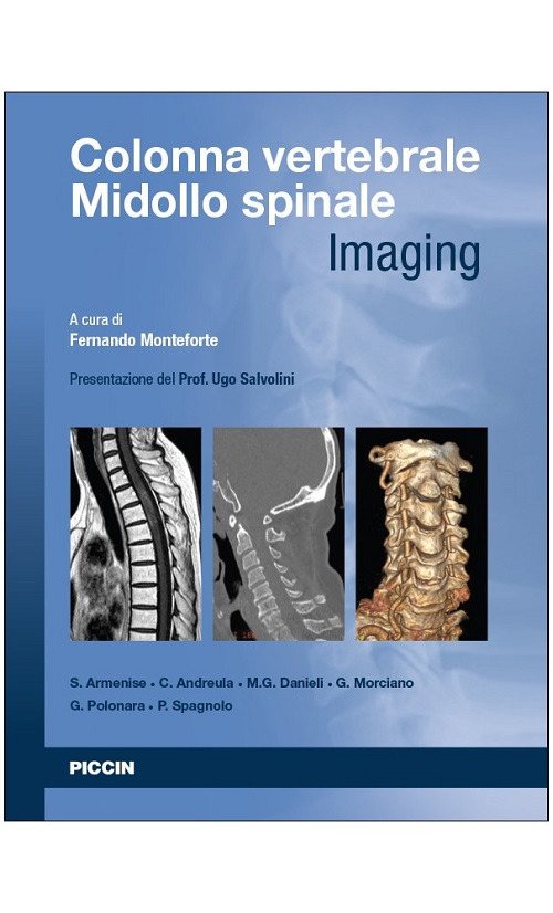 Colonna vertebrale. Midollo spinale. Imaging