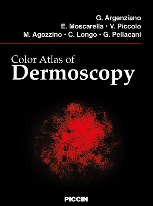 Color atlas of dermoscopy