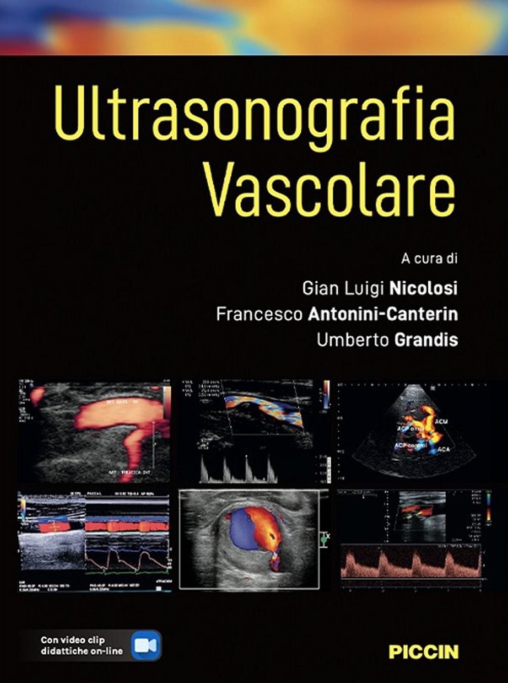 Ultrasonografia vascolare