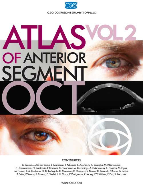 Atlas of anterior segment oct. Vol. 2