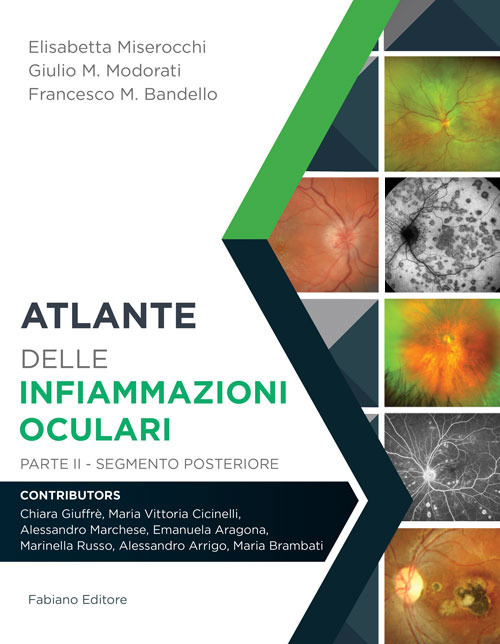 Atlante delle infiammazioni oculari. Vol. 2: Segmento posteriore