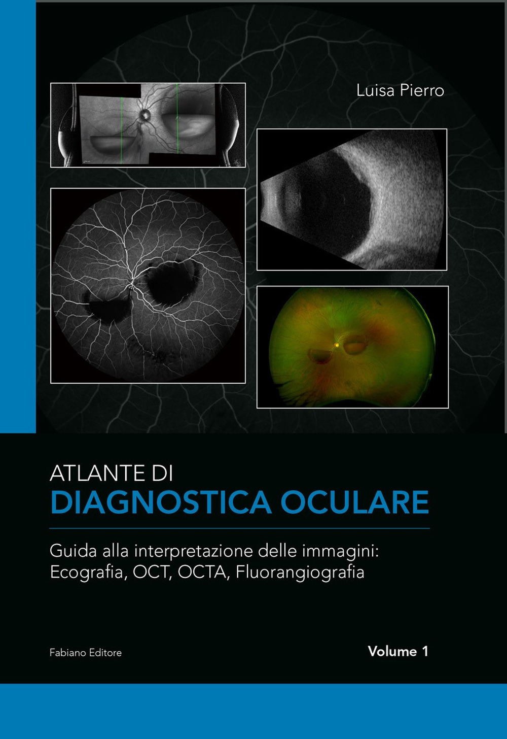 Atlante di diagnostica oculare. Vol. 1: Guida alla interpretazione delle immagini: Ecografia, OCT, OCTA, Florangiografia