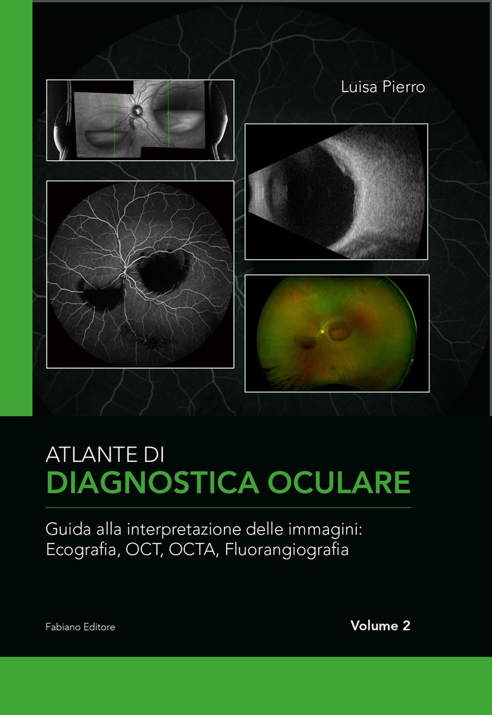 Atlante di diagnostica oculare. Vol. 2: Guida alla interpretazione delle immagini: Ecografia, OCT, OCTA, Florangiografia