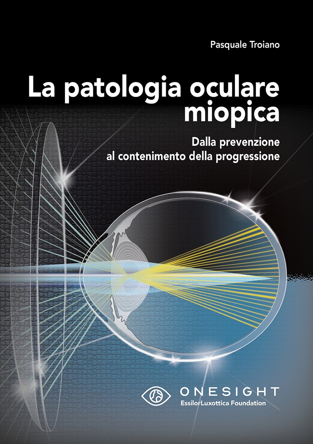 La patologia oculare miopica. Dalla prevenzione al contenimento della progressione