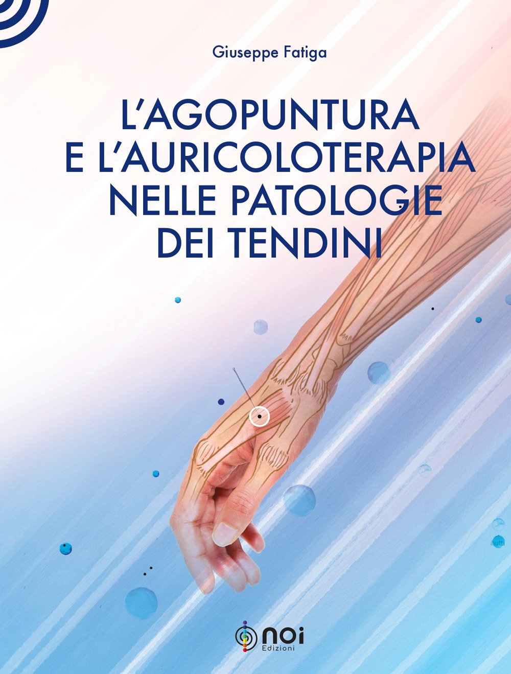 L'agopuntura e l'auricoloterapia nella patologia dei tendini