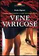 Causa, prevenzione e cure naturali delle vene varicose