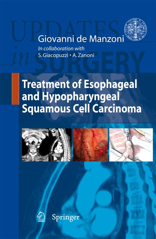 Treatment of esophageal and hypopharyngeal squamous cell carcinoma