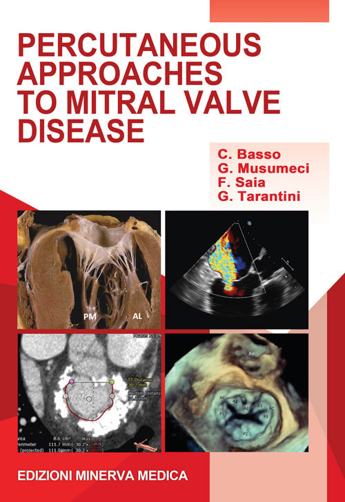 Percutaneous approaches to mitral valve disease