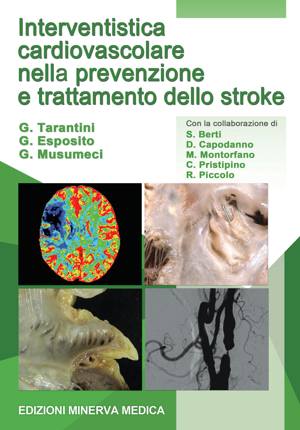 Interventistica cardiovascolare nella prevenzione e trattamento dello stroke