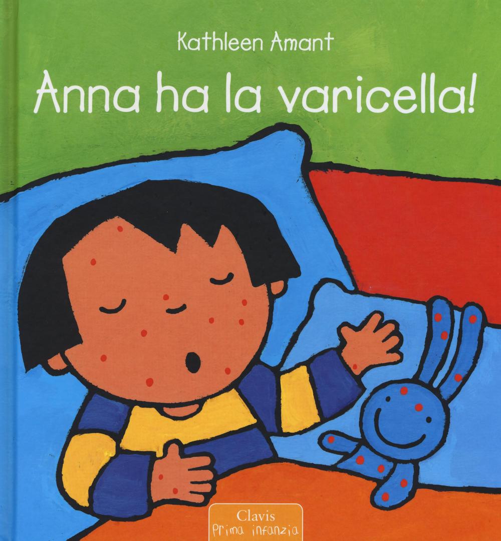 Anna ha la varicella!