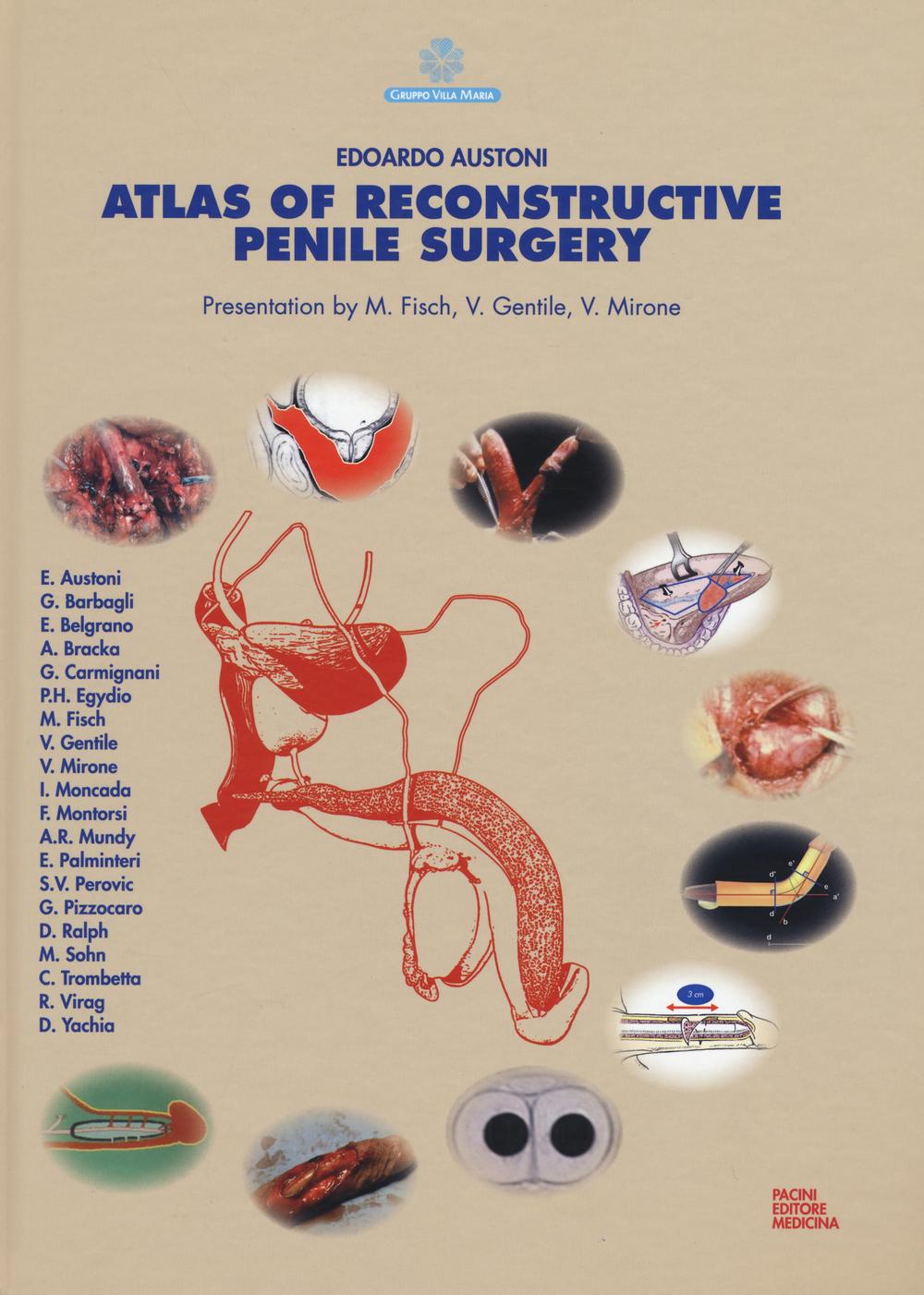 Atlas of reconstructive penile surgery