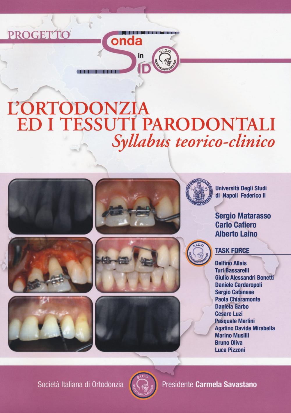L'ortondonzia ed i tessuti parodontali. Syllabus teorico-clinico