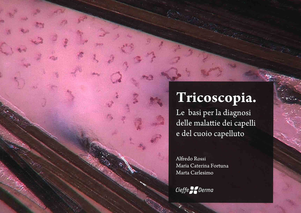 Tricoscopia. Le basi per la diagnosi delle malattie dei capelli e del cuoio capelluto
