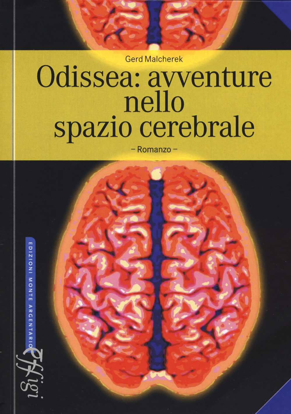 Odissea: avventure nello spazio cerebrale