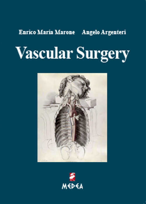 Vascular surgery