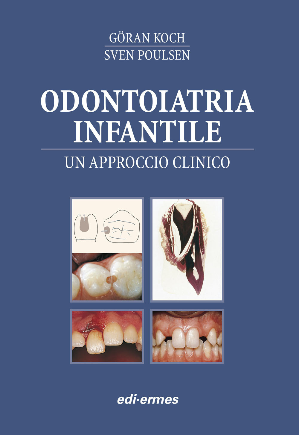 Odontoiatria infantile. Un approcio clinico
