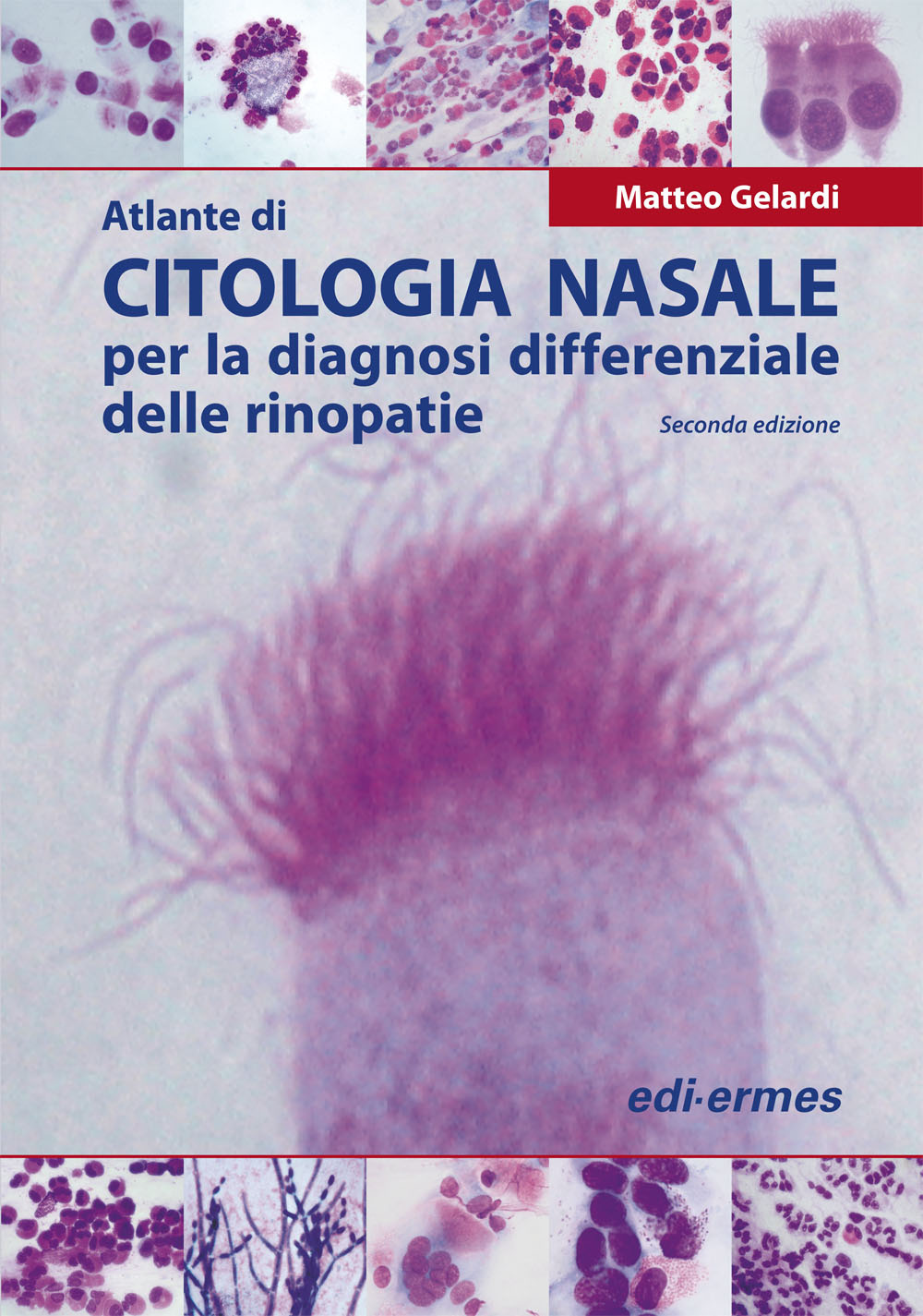 Atlante di citologia nasale per la diagnosi differenziale delle rinopatie