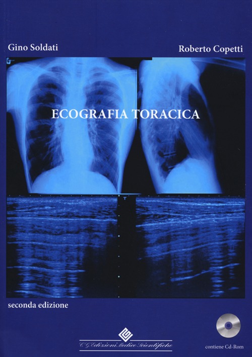Ecografia toracica