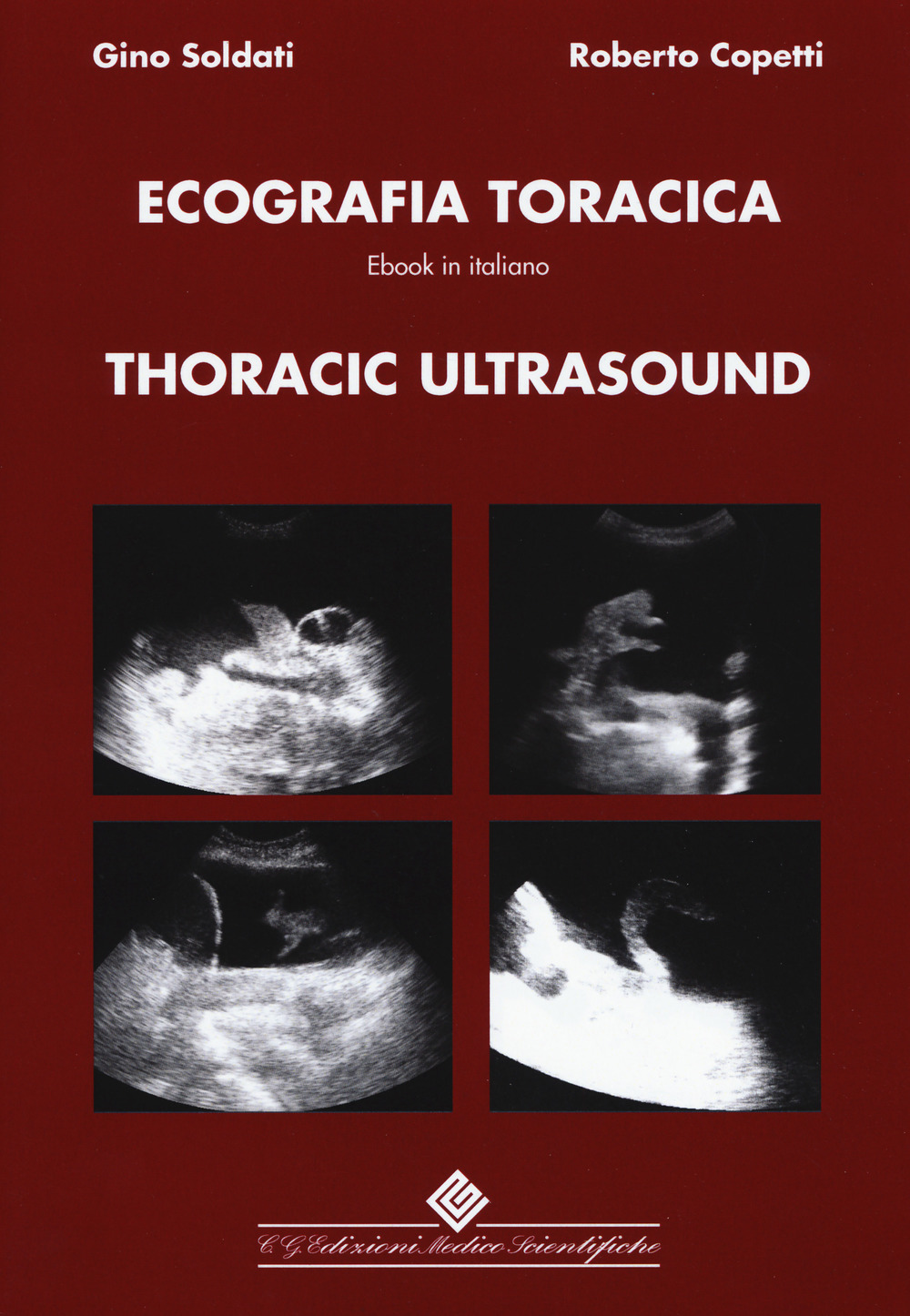 Thoracic ultrasound
