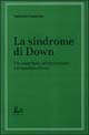 La sindrome di Down