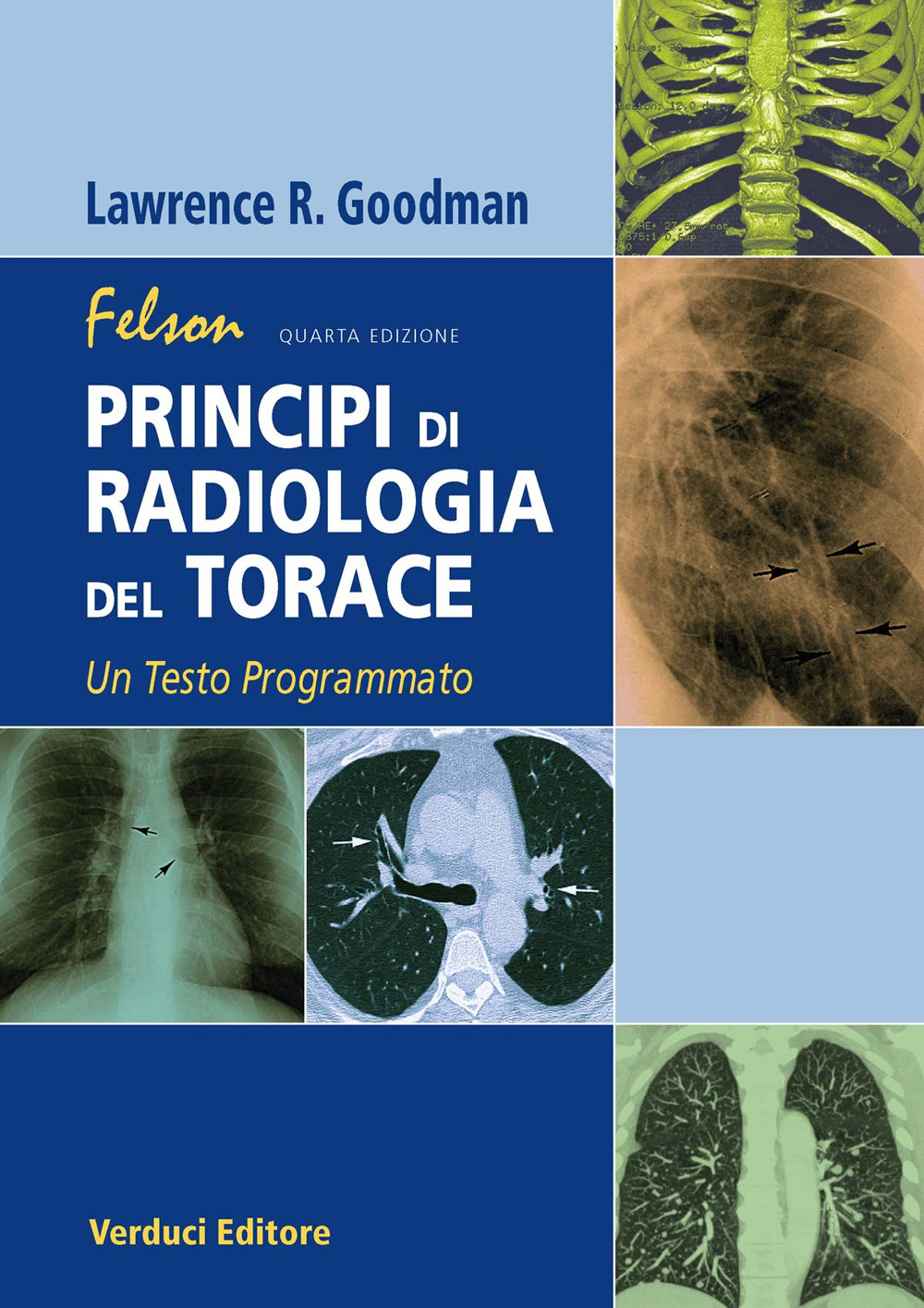 Felson. Principi di radiologia del torace. Un testo programmato