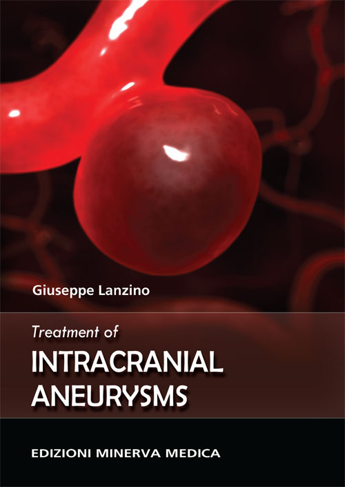 Treatment of intracranial aneurysms