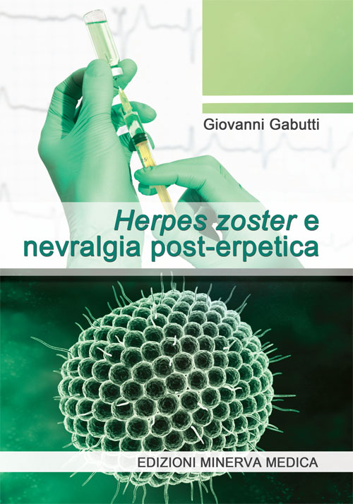 Herpes zoster e nevralgia post-erpetica