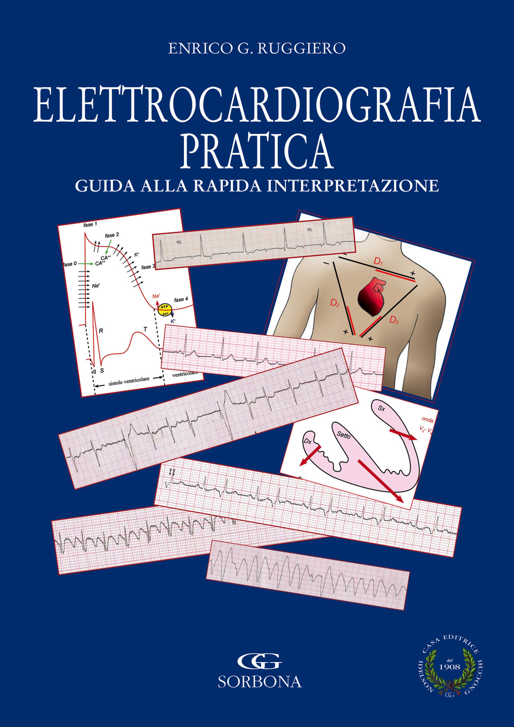 Elettrocardiografia. Rapida interpretazione. Terapia delle aritmie in area critica