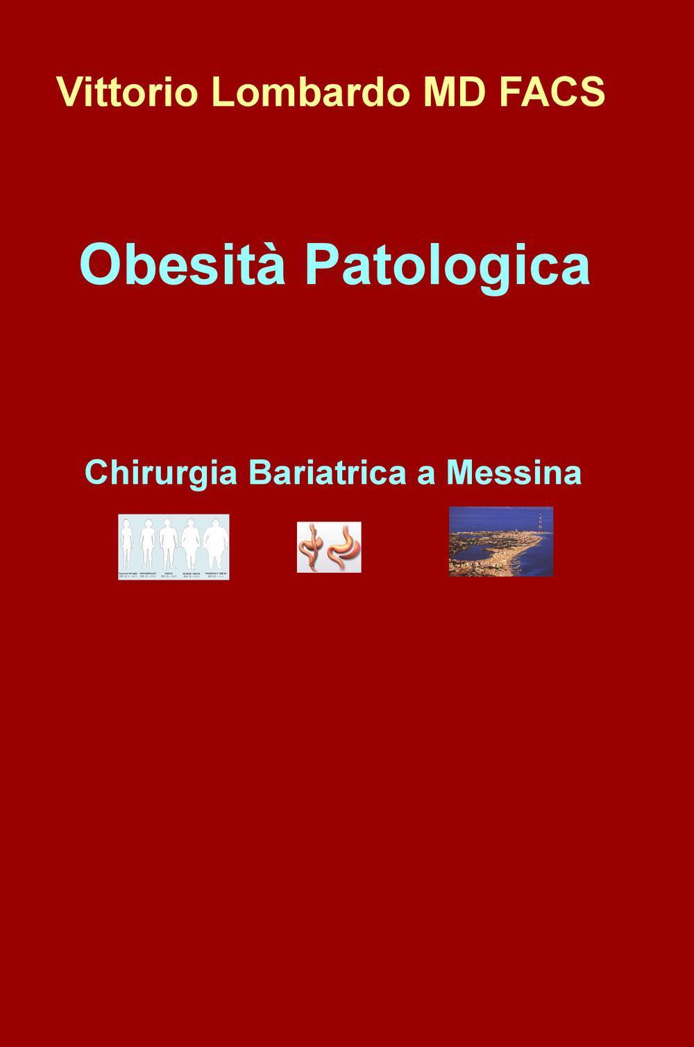 Obesità patologica. Chirurgia bariatrica a Messina
