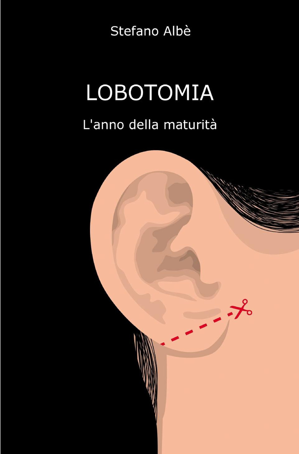 Lobotomia