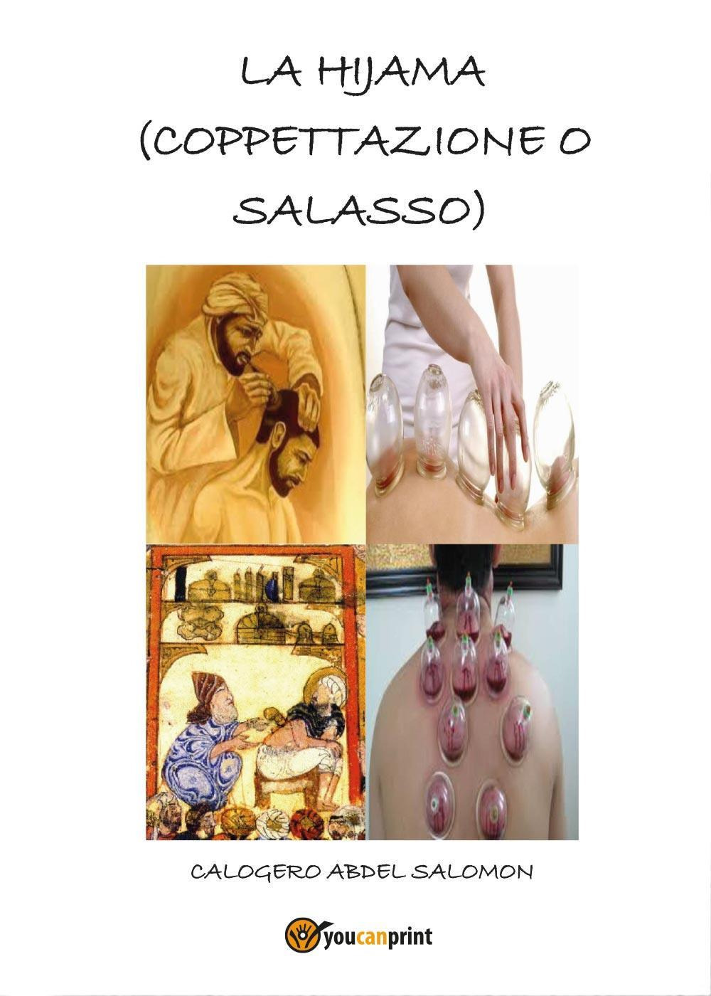 La hijama (coppettazione o salasso)