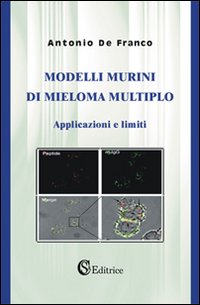 Modelli murini di mieloma multiplo. Applicazioni e limiti