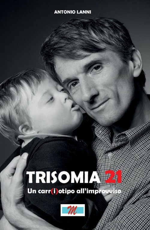 Trisomia 21. Un car(i)otipo all'improvviso
