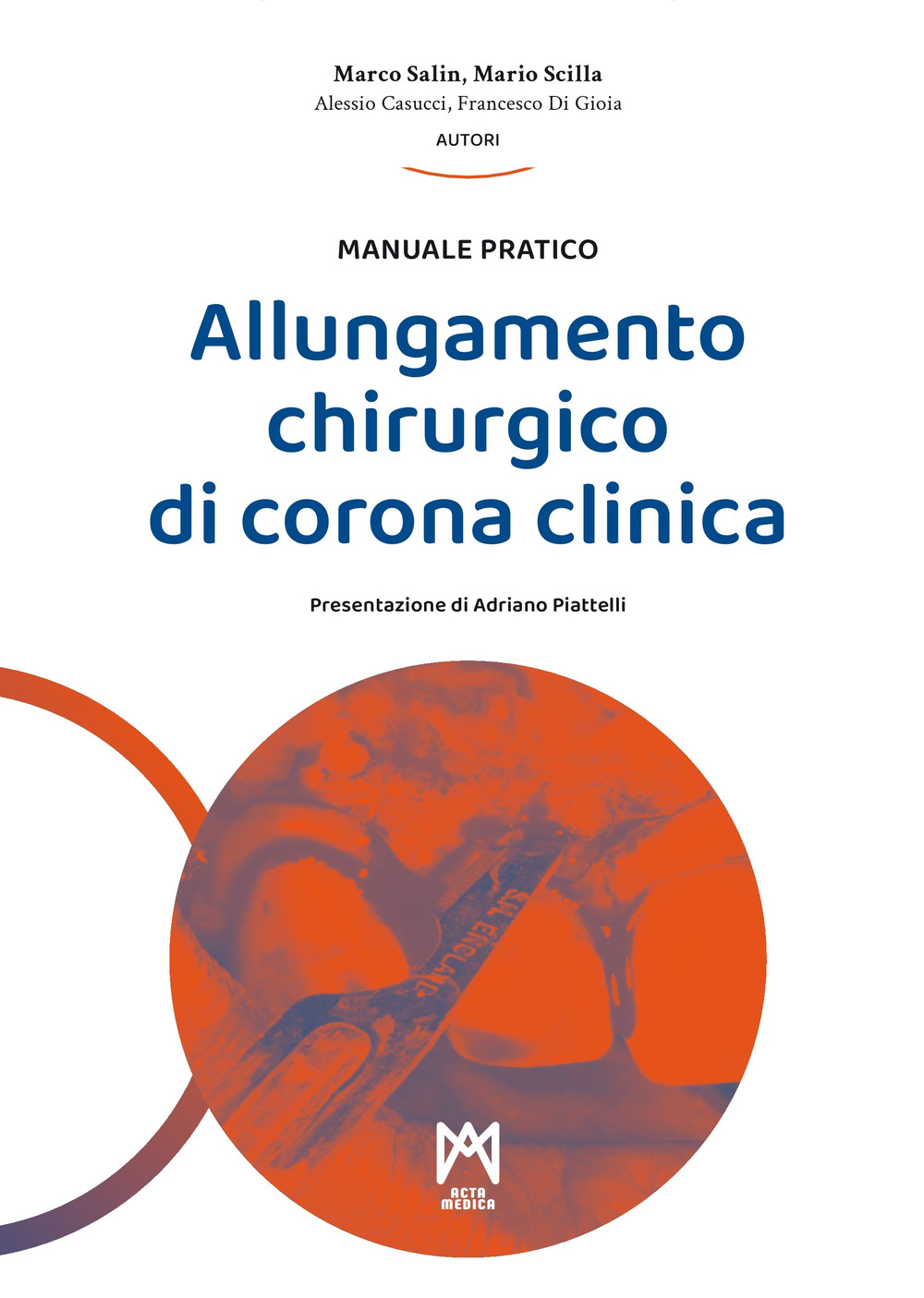 Allungamento chirurgico di corona clinica